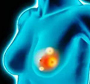 女性专项深度体检